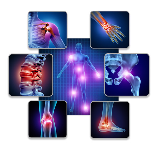 https://www.keherentherapy.co.uk/wp-content/uploads/2023/06/Joint-inflammation-.jpeg